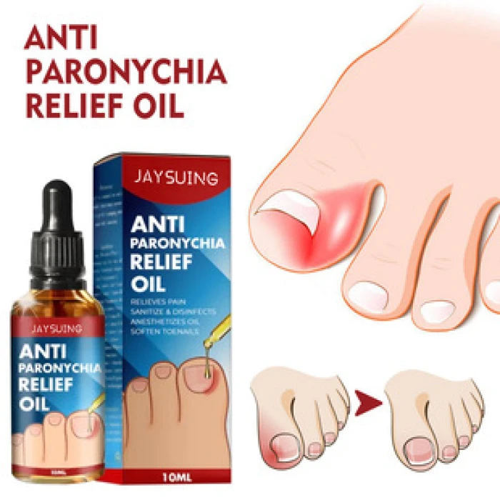 (1pcs) Jaysuing Anti Paronychia Relief Oil 10 ml